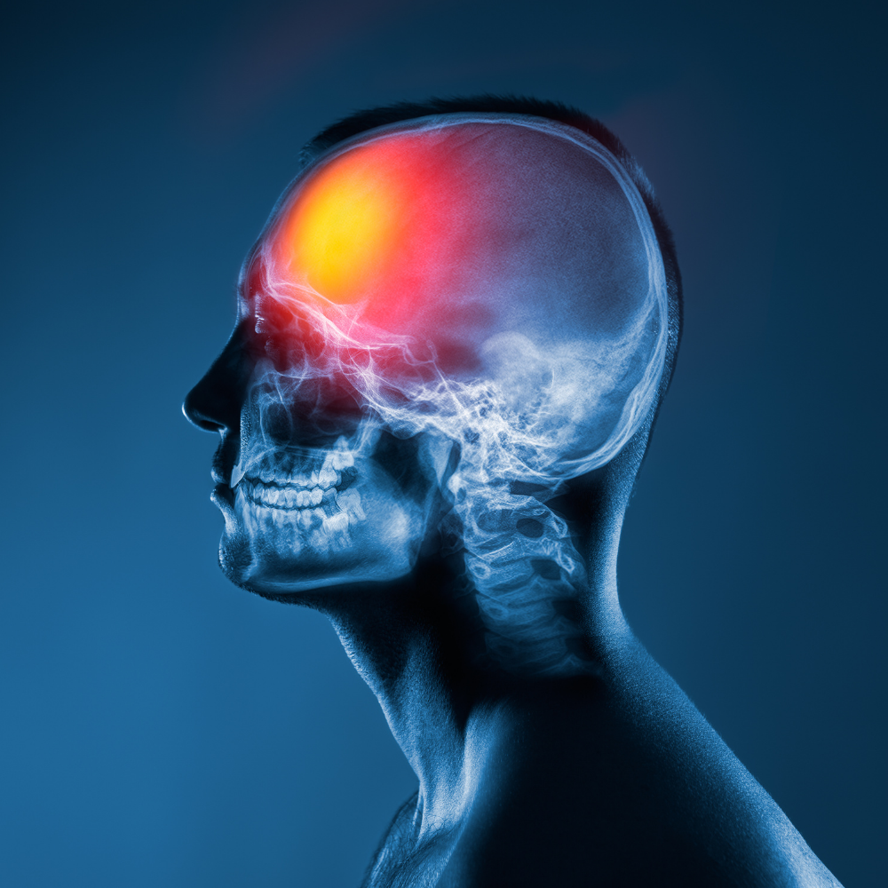 Brain Injuries Falling